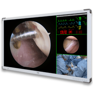 EIZO Surgical Monitors